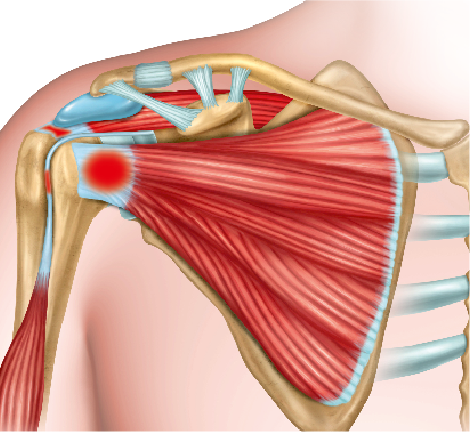 Medical illustration showcasing the rotator cuff, emphasizing the tendons and muscles around the shoulder joint.